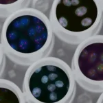 cyclospora parasite