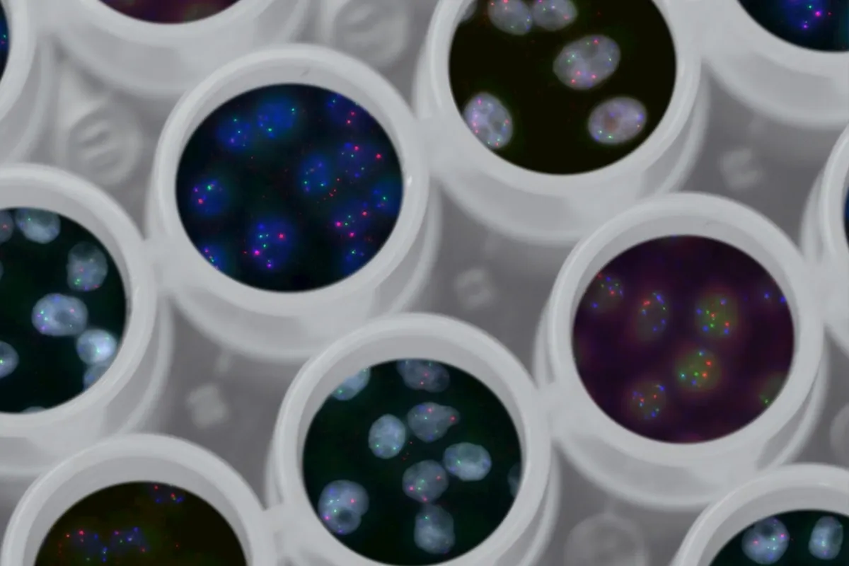 cyclospora parasite